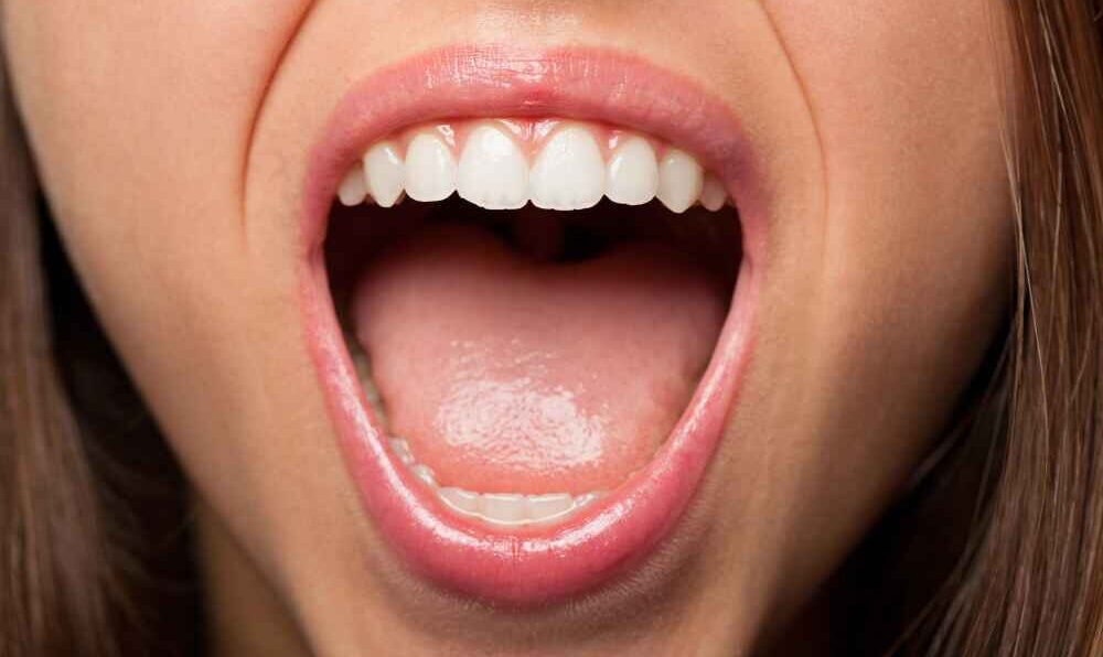 How to Cure Mouth Ulcers