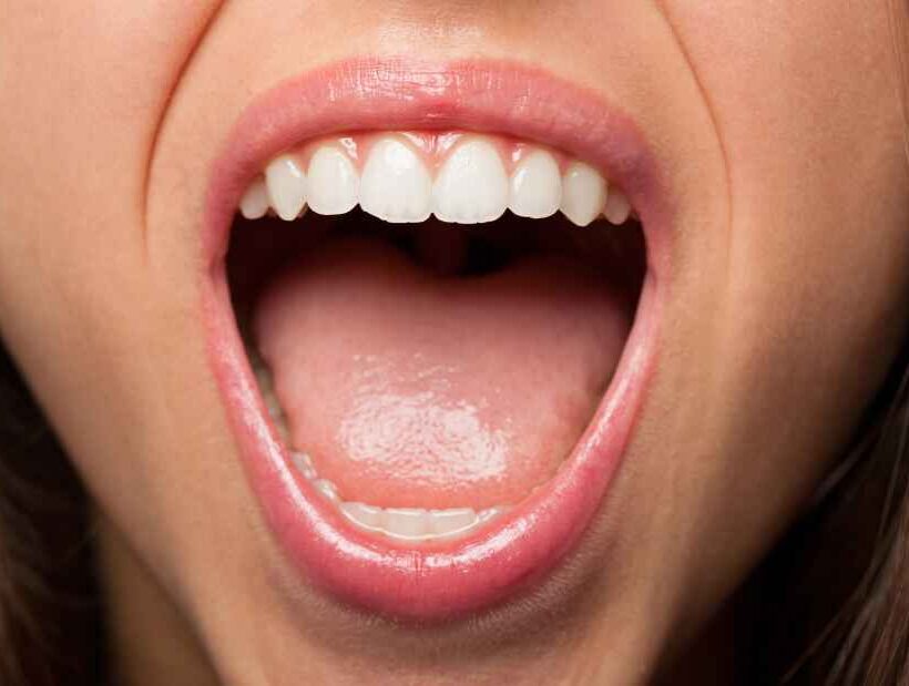 How to Cure Mouth Ulcers